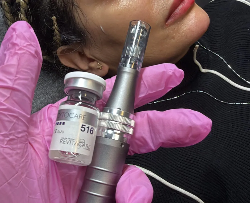 PRP (Face) at Roniya Aesthetic Clinic